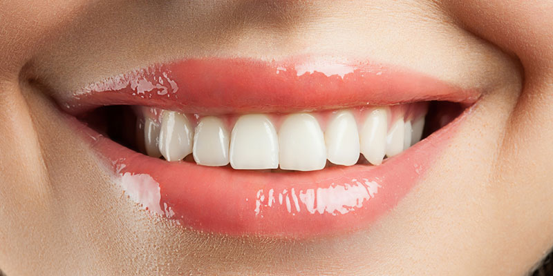 
Ästhetische Zahnmedizin
